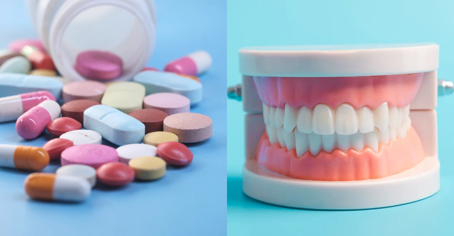 Opioids and Dental Pain 2